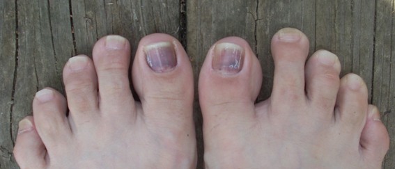 My purple toes!